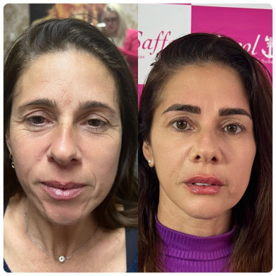 WhatsApp Image 2024-11-07 at 17.23.54